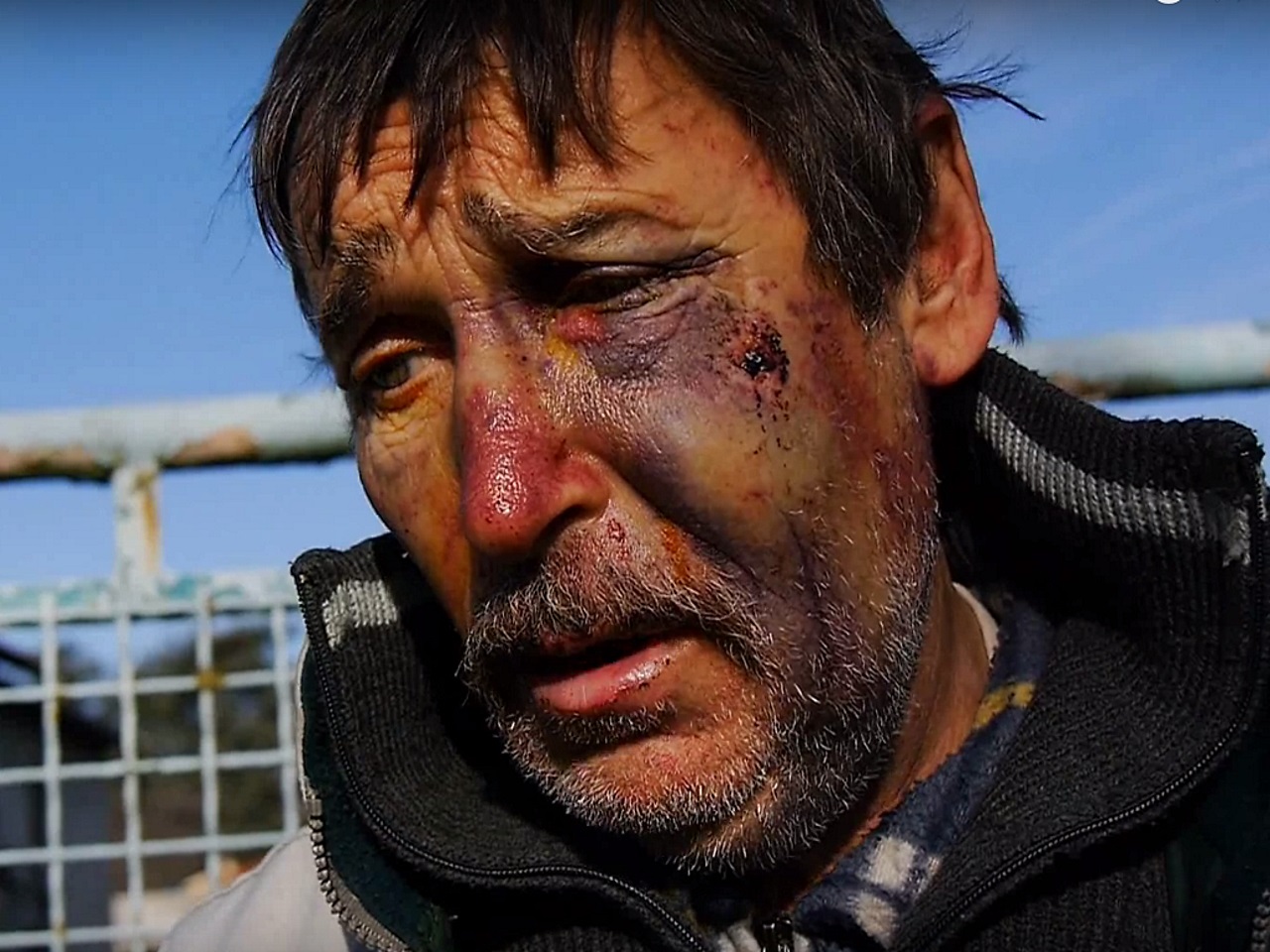 Philippe Layat, l'agriculteur opposant au Grand Stade, tabass&eacute; chez lui