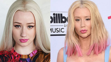Les fans d'Iggy Azalea choqués par ses chirurgies esthétiques Les fans d'Iggy Azalea choqués par ses chirurgies esthétiques
