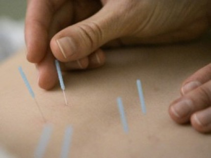 Apprendre à établir un diagnostic et soigner par l’acupuncture de l’oreille Apprendre à établir un diagnostic et soigner par l’acupuncture de l’oreille