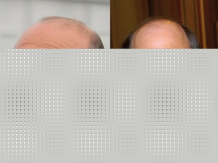 G&eacute;rard Collomb sanctionne Etienne T&ecirc;te