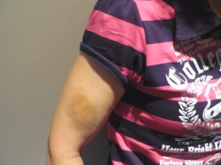 Une nouvelle permanence pour les femmes battues à Lyon Une nouvelle permanence pour les femmes battues à Lyon