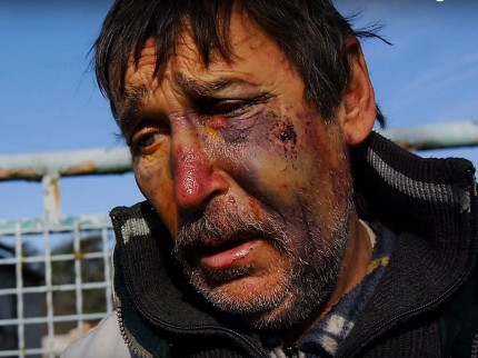 Philippe Layat, l'agriculteur opposant au Grand Stade, tabassé chez lui Philippe Layat, l'agriculteur opposant au Grand Stade, tabassé chez lui